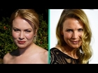 What Did Renee Zellweger Do to Her Face? Plastic Surgeon Weighs In