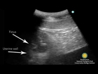 Mei Xiang Ultrasound Video Clip