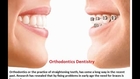 Dental Treatments - Chelsea Dental SPA
